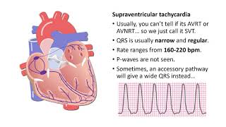 1 Types of Tachyarrhythmias [upl. by Mariele716]