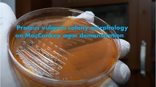 Proteus vulgaris colony characteristics on Macconkey agar [upl. by Aneleasor694]