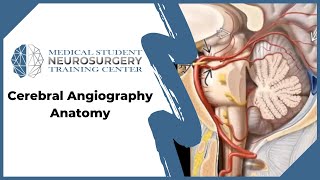 Cerebral Angiography Anatomy [upl. by Alanah]