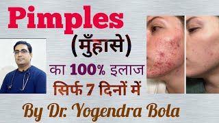 Acne मुँहासे ka COMPLETE treatment  acnestar gel amp soap femcinol A gel Benz Adp gel by DR BOLA [upl. by Casandra]