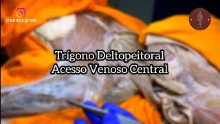 Anatomia do trígono deltopeitoral veia cefálica acesso venoso central infraclavicular [upl. by Siclari]