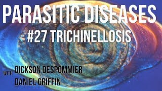 Parasitic Diseases Lectures 27 Trichinellosis [upl. by Claudia809]