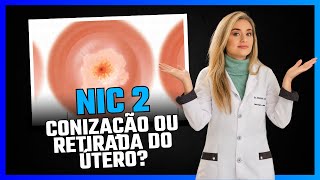 Nic 2 Conização ou retirada do útero [upl. by Nosaes]