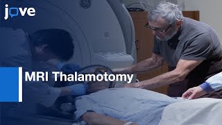 MRI Thalamotomy with ET for Medicallyrefractory Essential Tremor  Protocol Preview [upl. by Aserret452]