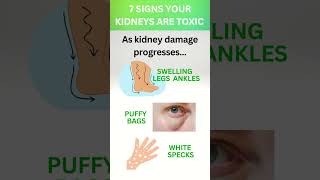 7 Warning Signs That Your Kidneys Are Toxic [upl. by Adnelg360]