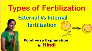 IVF Treatment for Pregnancy Urdu Hindi  Test Tube Baby  Banjhpan Ka Ilaj  In Vitro Fertilization [upl. by Eniffit]