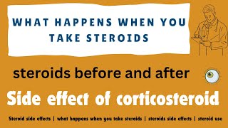 Steroid side effects  what happens when you take steroids  steroids side effects  steroid use [upl. by Seto306]