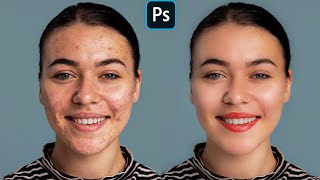 Face Retouching  Best Photoshop Tutorial  Skin Retouching [upl. by Simson]