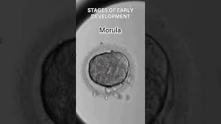 Early development of human  Cleavage  morula  blastulation [upl. by Ttelrats371]