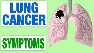 Lung Cancer  All Symptoms [upl. by Matthieu]