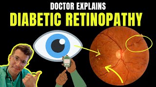 Doctor explains DIABETIC RETINOPATHY eye disease  STAGES SYMPTOMS PREVENTION AND TREATMENT [upl. by Aniroz]