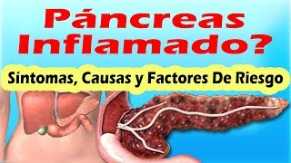 SINTOMAS DE PANCREATITIS AGUDA Y CRONICA Sintomas Del Pancreas Inflamado y Sus Causas [upl. by Ahsirat36]