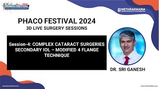 Secondary IOL  Modified 4 Flange Technique  Dr Sri Ganesh Complex Cataract Surgeries [upl. by Heloise]