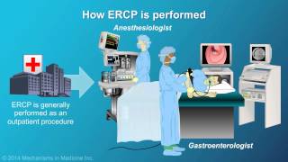 Understanding ERCP Endoscopic Retrograde Cholangiopancreatography [upl. by Pedroza]