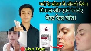 alite face wash charcoal benefits  alite anti acne face wash charcoal  alite face wash [upl. by Thisbe312]