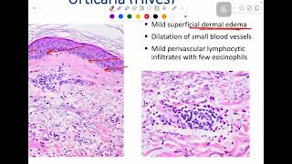 MSS pathology lab 1  part 1 [upl. by Karena]