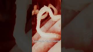 Tapeworm in Human Intestine  Taenia sp  Flat worms  Endoparasites  Phylum Platyhelminthes [upl. by Ecienal]