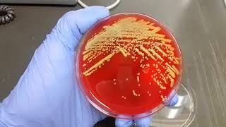 Micrococcus Luteus [upl. by Nomahs]