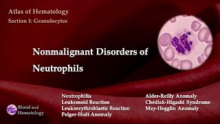 Nonmalignant Disorders of Neutrophils [upl. by Aihsatan]