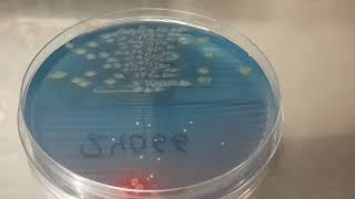 Colony characteristics of Pseudomonas aeruginosa on CLED Agar of Urine Culture [upl. by Eelidnarb]