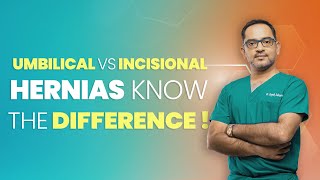 What is an Umbilical and Incisional hernia  Dr Deepak Subramanian [upl. by Refeinnej]