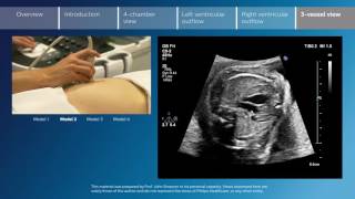 Key screening views of the fetal heart  Part 6  Vessel view [upl. by Araek]