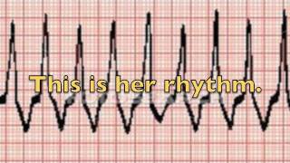 ACLS Megacode Simulation Two [upl. by Ahsieat]