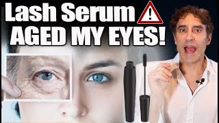 LASH SERUM⚠️WARNING⚠️ EXPOSED for AGING YOUR EYES  Lash Conditioner may Be Aging Your Eyes [upl. by Pessa]