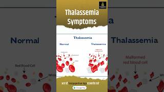 THALASSEMIA  Causes Symptoms amp Treatment Causes Symptoms treatment thalassemia [upl. by Bunting]