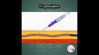 💉 INTRAVENOUS IV CANNULATION ANIMATION [upl. by Aik]