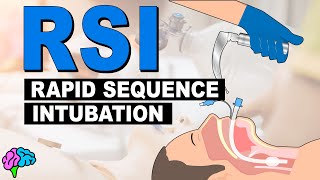 What is Rapid Sequence Intubation RSI [upl. by Nylarat]