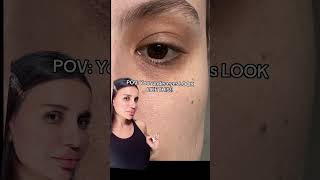 Do your under eyes look like this skincare skincaretips darkundereyes skincareroutine beauty [upl. by Bradeord529]