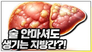 내 안에 껴 있는 지방간 그 치료법은 메디25 [upl. by Eicrad]