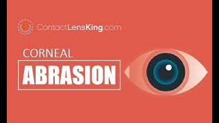 Corneal Abrasion Scratched Eye Symptoms Causes and Treatment [upl. by Eirovi]