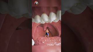 What Is The Purpose Your Uvula [upl. by Adler]