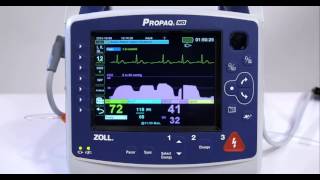 Propaq MD Capnography [upl. by Arhaz185]