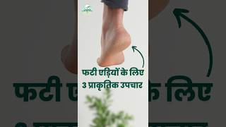 Top 3 Home Remedies for Cracked Heels  Cracked Heels Removel shorts [upl. by Eednim]