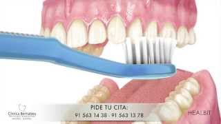 Limpieza dental  Recomendaciones [upl. by Negrom]