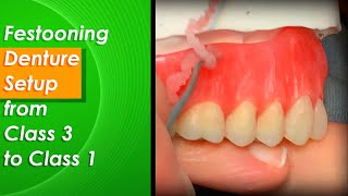 Festooning Denture Setup from Class 1 to Class 3 [upl. by Kcin]