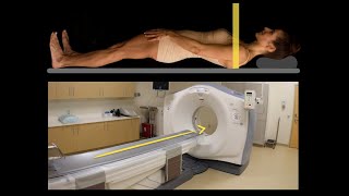 Anatomy of CT scans Introduction [upl. by Nyliahs]