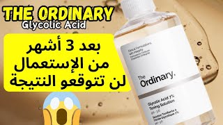 تجربتي مع glycolic acid the ordinary  the ordinary glycolic acid [upl. by Nealson]