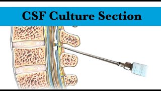 Cerebrospinal Fluid CSF culture Section by ASM Minds Team [upl. by Beattie]