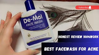 DeMal facewash  Honest review  price and how to use it [upl. by Ansel]