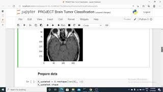 Brain Tumor Classification MRI  Brain Tumor Detection using Support Vector Machine in Python [upl. by Israel]