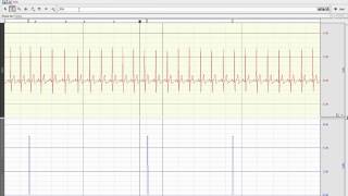 Noldus Observer XT import export in AcqKnowledge 43 [upl. by Anahpets]