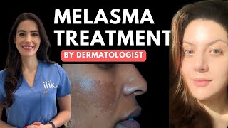 Dermatologist approved routine for Melasma  How to use hydroquinone [upl. by Aeki]