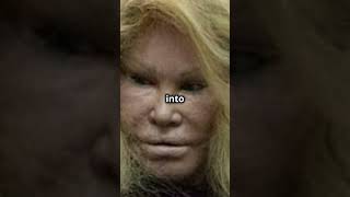 Catwoman Jocelyn Wildenstein shocking photos [upl. by Colpin]