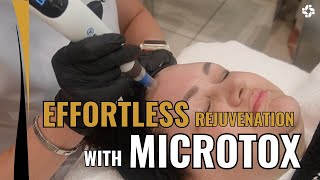 Ultimate Rejuvenation with MicroTox [upl. by Leeanne]