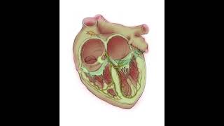 Ablation of AV node reentrant tachycardia AVNRT [upl. by Silin]