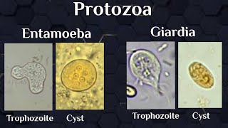 microscopical exam Protozoal trophozoites amp cysts [upl. by Nanine]